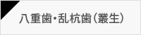 八重歯・乱杭歯(叢生)